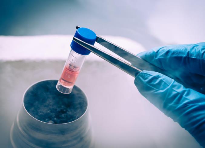 凍存提取 凍存提取